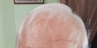 El enigma de la quíntica: Historia y Trascendencia